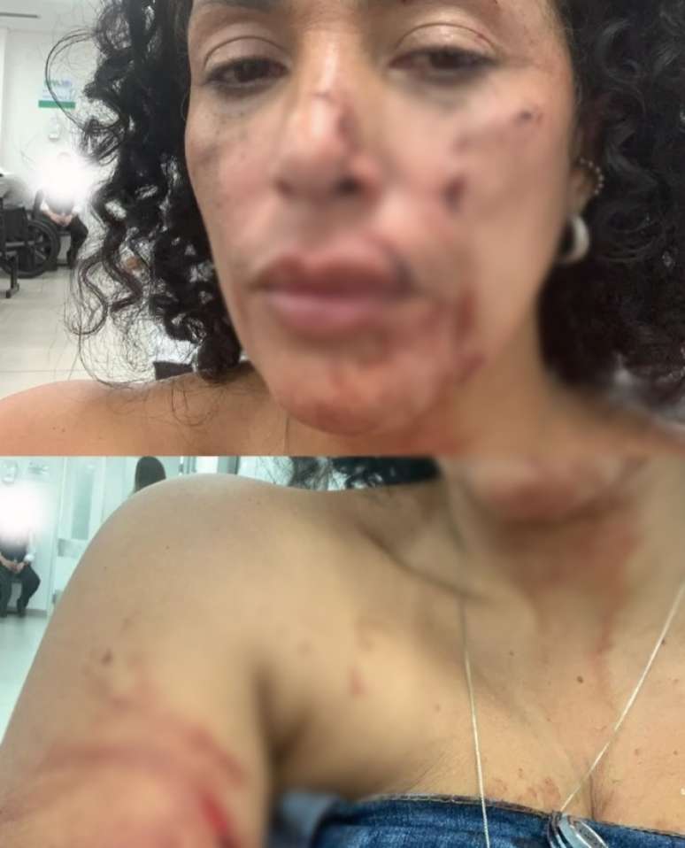 Vítima ficou ferida após ocorrido em bar
