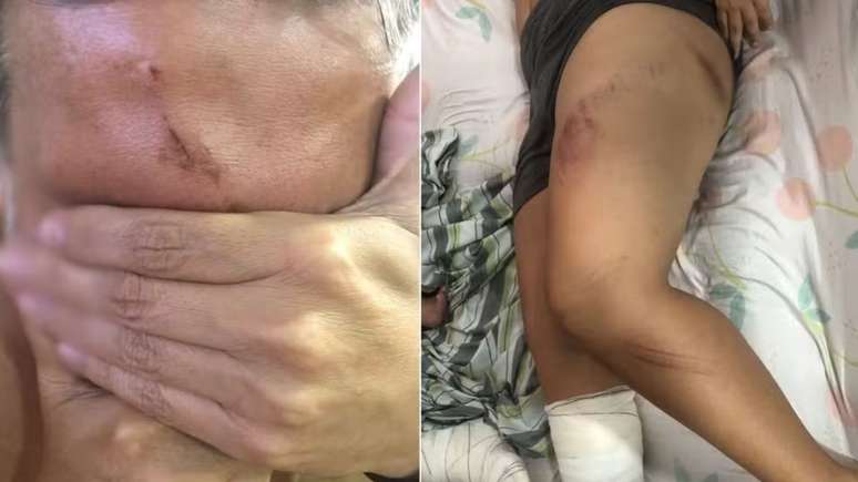 Pai e filho est&atilde;o entre os turistas feridos em acidente que aconteceu em cratera