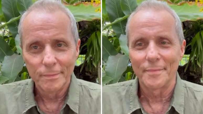 Tony Bellotto é diagnosticado com tumor