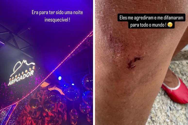 Mulher acusada de morder pessoas em camarote na Sapucaí nega o fato e afirma ter sofrido violência de Guardas Municipais