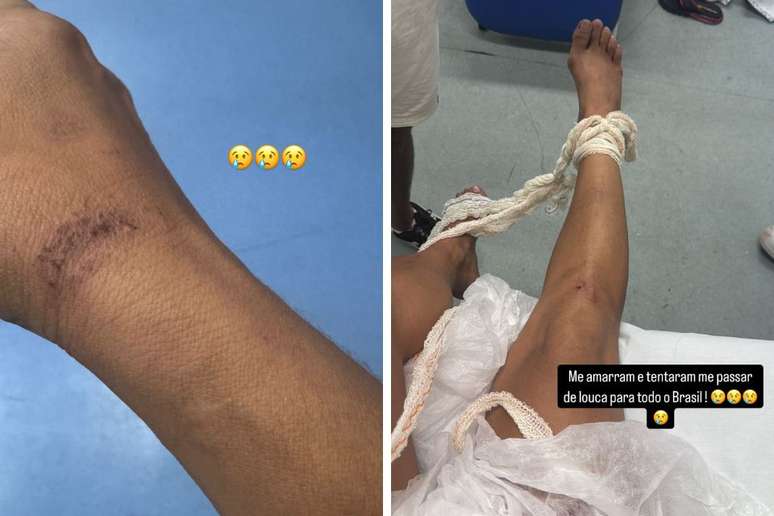 A mulher publicou fotos nas redes sociais mostrando machucados após abordagem