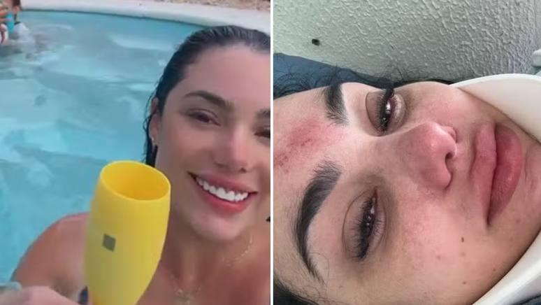 The woman breaks cervical and almost drowns when she has blocked hair in a suction cup: “I thought she was dying”