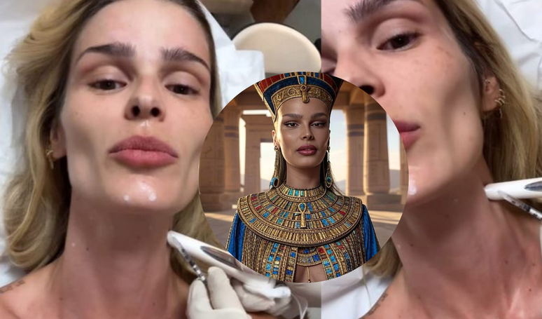 Cleopatra Face? Yasmin Brunet performs an aesthetic procedure to soften wrinkles and improve the outline of the jaw inspired by the Egyptian queen; “Botox Nefertiti!”