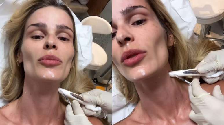 Botox Nefertiti: conheça o procedimento realizado por Yasmin Brunet