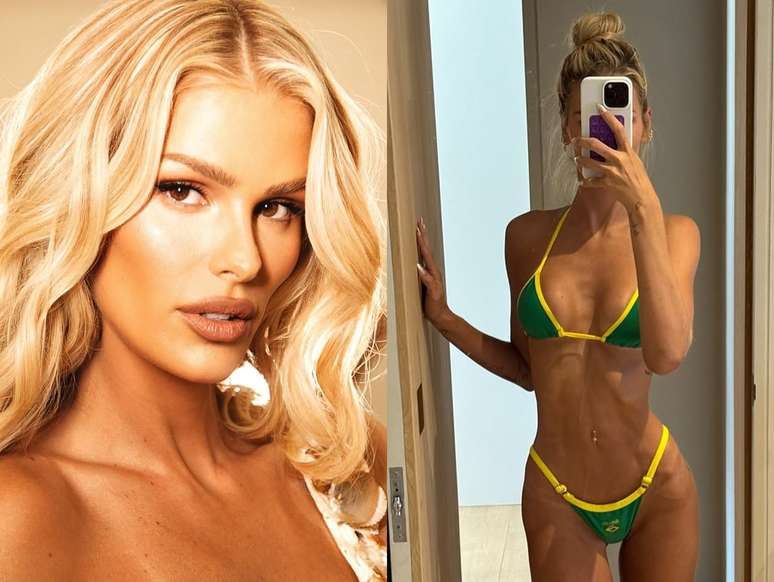 What is Lipedema, a disease that has almost taken Yasmin Brunet from BBB