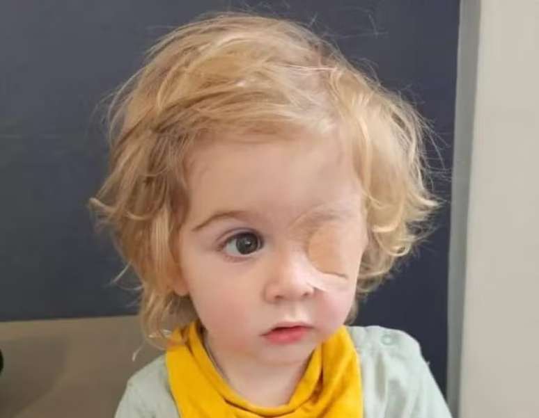 Juwan apresentou uma infecção que não se curava com colírios comuns