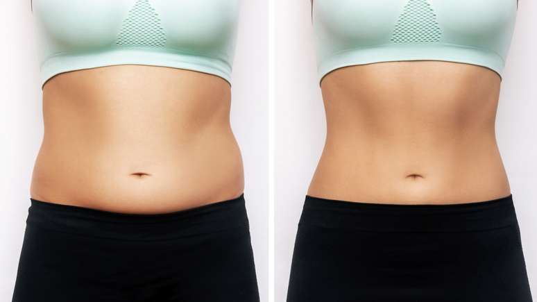 These are the new technologies that promise to revolutionize the removal of body fat, according to the plastic surgeon