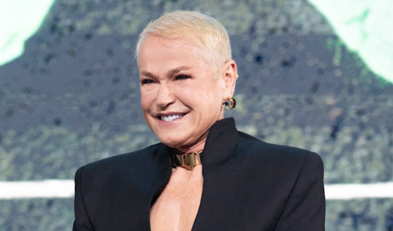 3D microscope, sapphire and more blade: prepare to be surprised by the innovative hair transplant technique Xuxa