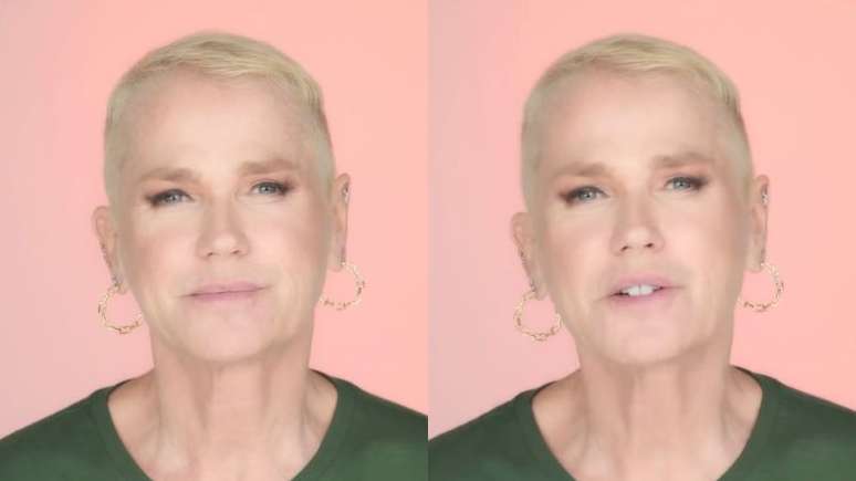 Xuxa Meneghel revela que fez implante capilar; apresentadora sofre com condição hereditária e detalha tratamento realizado