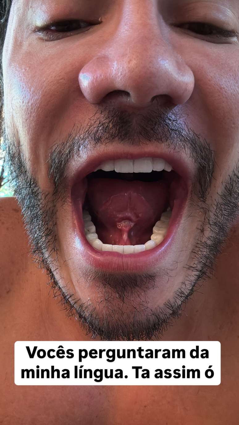 Reprodu&ccedil;&atilde;o/Instagram