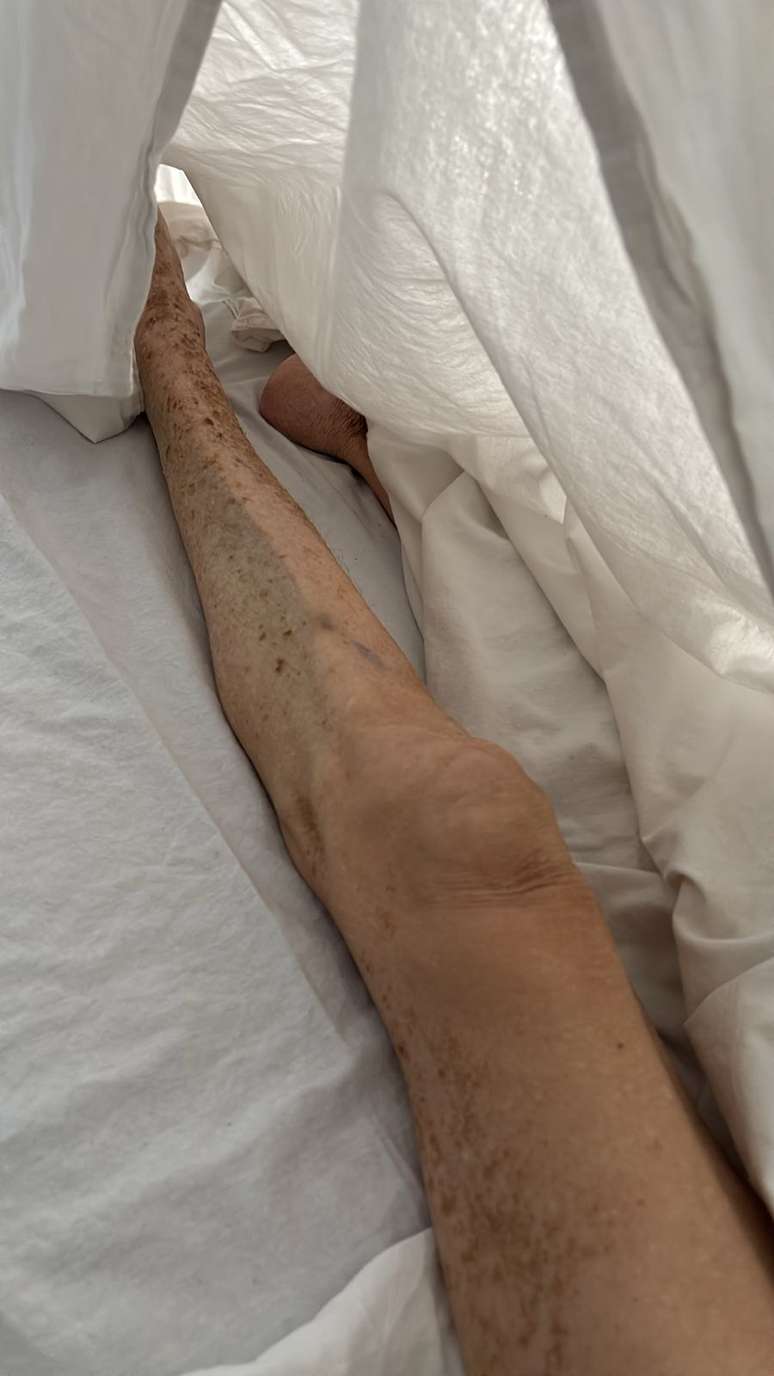 Idosa foi deixada aos cuidados do Cais frágil, com feridas e hematomas