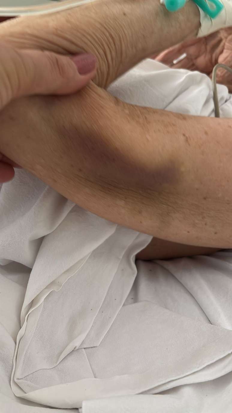 Idosa foi deixada aos cuidados do Cais frágil, com feridas e hematomas