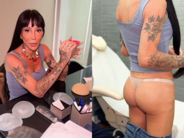 Maya Massafera desiste de PMMA e anuncia nova pr&oacute;tese no bumbum: &ldquo;Quero maior&rdquo;