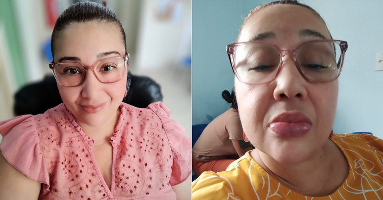 Educadora ficou sem poder comer por dias após usar creme dental interditado pela Anvisa