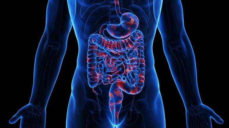 O bloqueio de partes do intestino impede o processo de digestão e causa diversos sintomas