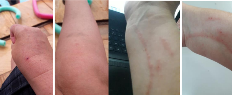 Professora foi mordida e agredida, diz advogado