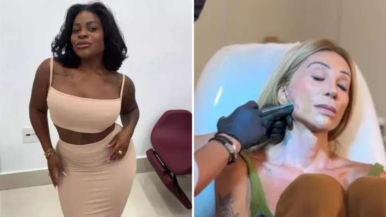 'Rosto derretido': Conheça fenômeno que afeta famosas como Jojo Todynho e Maya Massafera