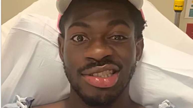 Lil Nas X disse que perdeu "controle do lado direito do rosto"