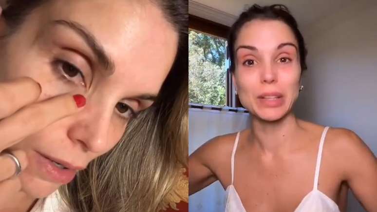 Flávia Viana desabafou ao sofrer uma alergia antes do casamento da amiga