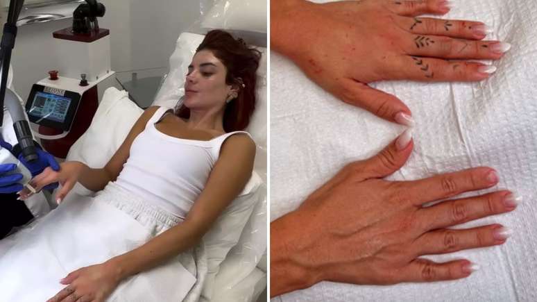 Harmonização de mãos: Conheça o procedimento que está encantando as famosas