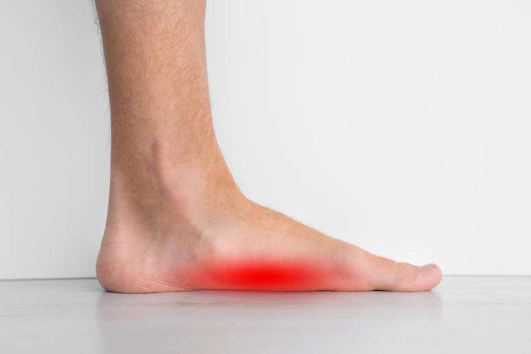 A fascite plantar é comum em atletas, em pacientes mais idosos e também em mulheres que usam salto alto com frequência