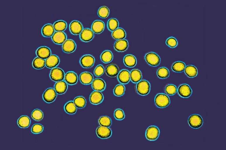 A Staphylococcus aureus é uma bactéria comum que pode estar envolvida em algumas doenças de pele