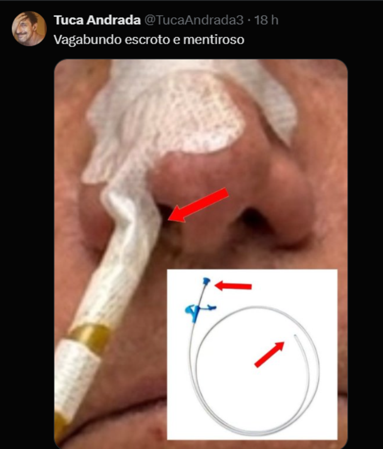 Tuca Andrade berbicara tentang rawat inap Bolsonaro 