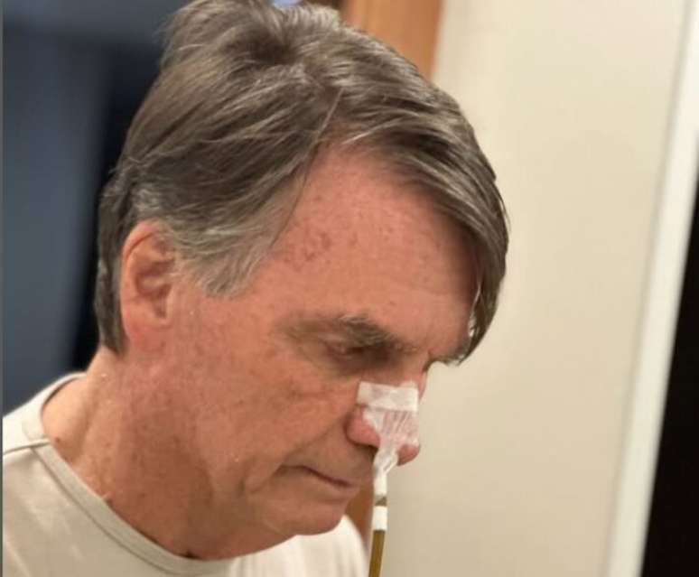 O ex-presidente Jair Bolsonaro (PL) está há nove dias internado no Hospital DF Star, em Brasília