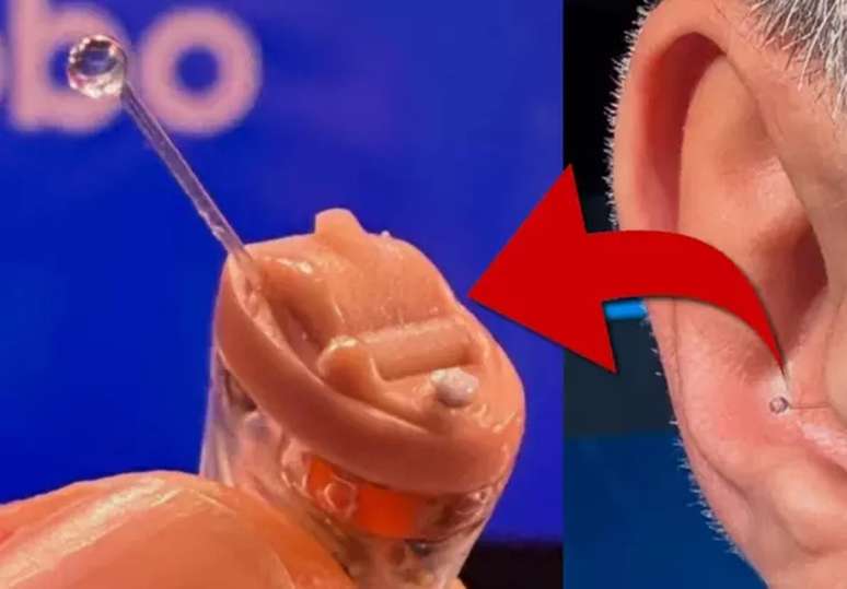 O ponto eletr&ocirc;nico, aparelho quase impercept&iacute;vel que ajuda atores e apresentadores