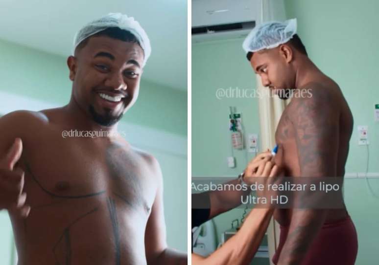 David Brito shows the Lipo HD results and the fans react: “If you have a character surgery, Fallo”