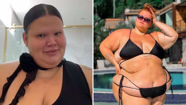 Thais Carla gives enough attacks after suffering bariatric surgery: “The body is mine”