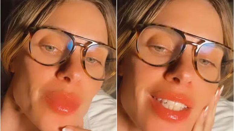 Carolina Dieckmann sofre rea&ccedil;&atilde;o al&eacute;rgica ap&oacute;s voo: 'Triplicou de tamanho'