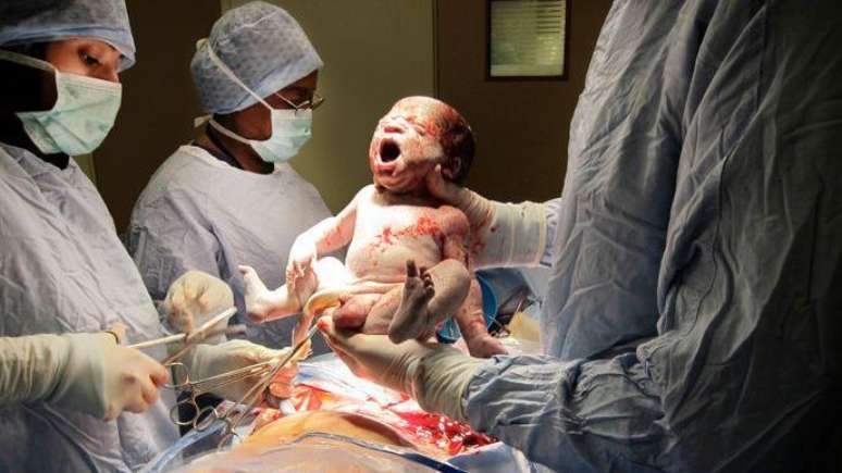 A expectativa de vida ao nascer tem crescido ano ap&oacute;s ano no Brasil