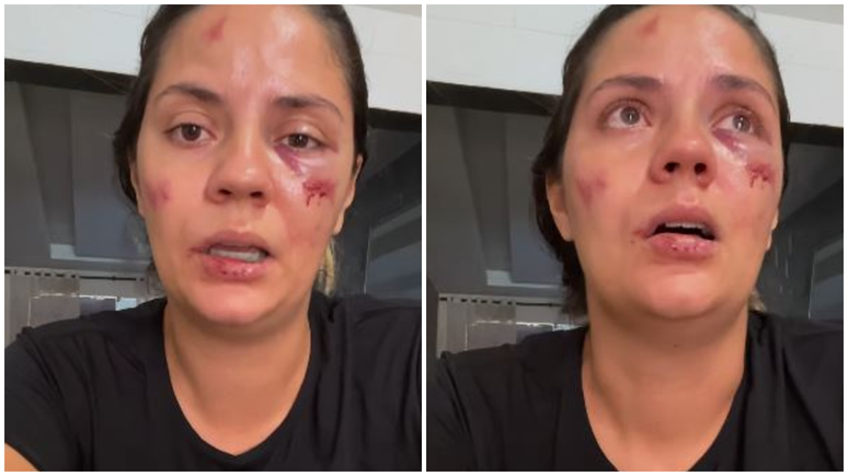 Mulher é arremessada de montanha-russa em parque aquático recém-inaugurado: 'Foi desesperador'