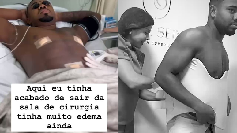 Davi Brito mostra resultado de lipo HD quase duas semanas após a cirurgia