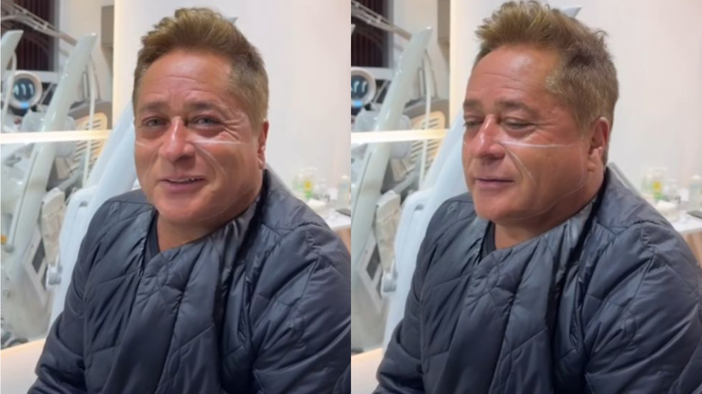 Vain? The singer Leonardo performs aesthetic procedure and surprises: “Lisinho”