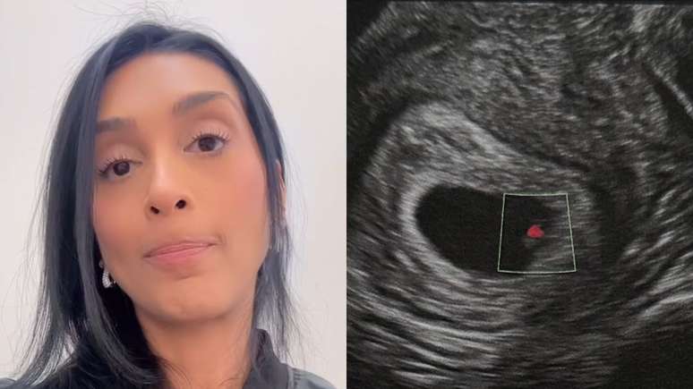 Former BBB Amanda Djehdian makes a tough vent on mom after losing the baby: “Angel” Former BBB Amanda Djehdian makes a tough vent on mom after losing the baby: “Angel”