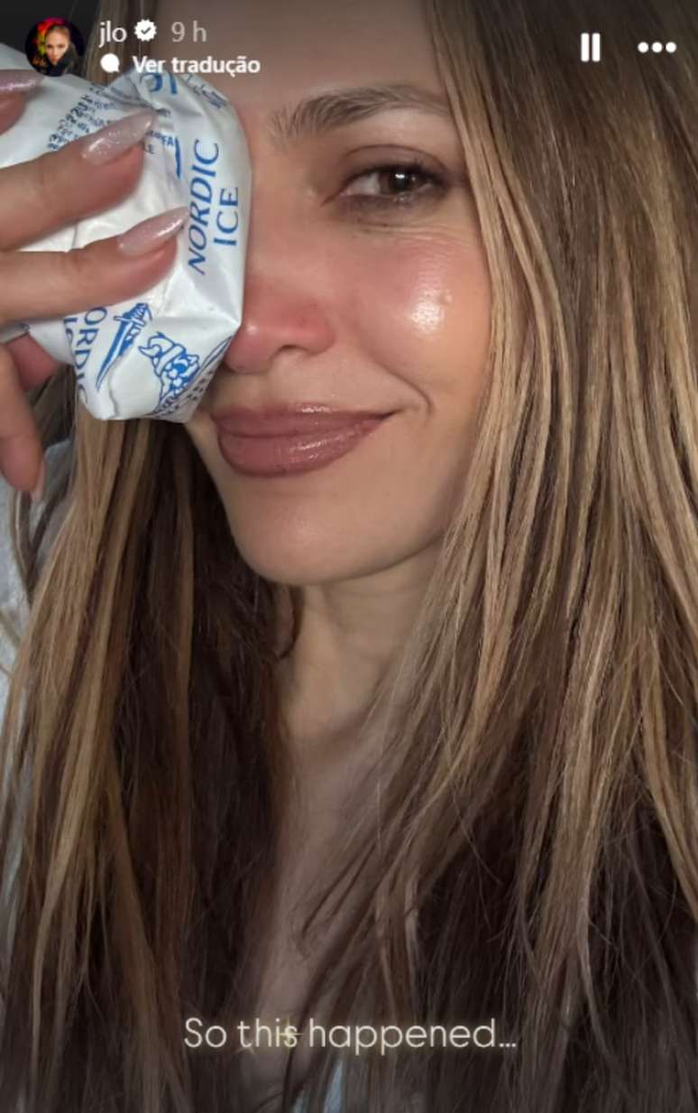Jennifer Lopez mostra corte após acidente em ensaio de premiação