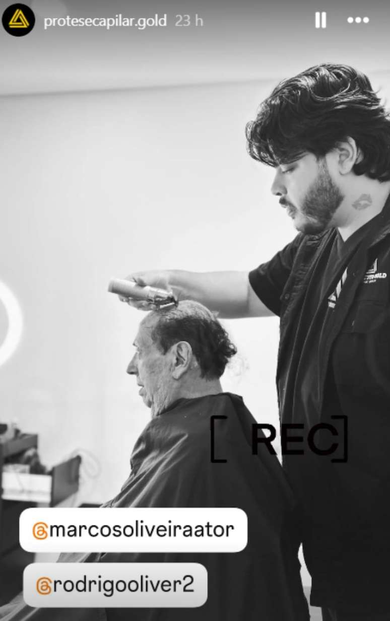 Marcos Oliveira mostra prótese capilar