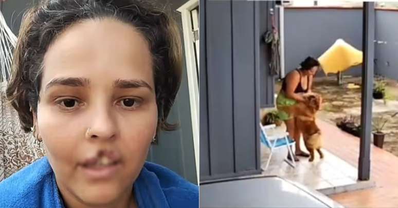 Mulher teve lábio arrancado por cachorro em RO