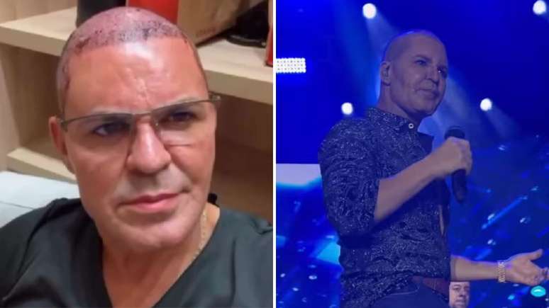 Eduardo Costa makes a Calvo show: “I’m not worried about my appearance” Eduardo Costa makes a Calvo show: “I’m not worried about my appearance”