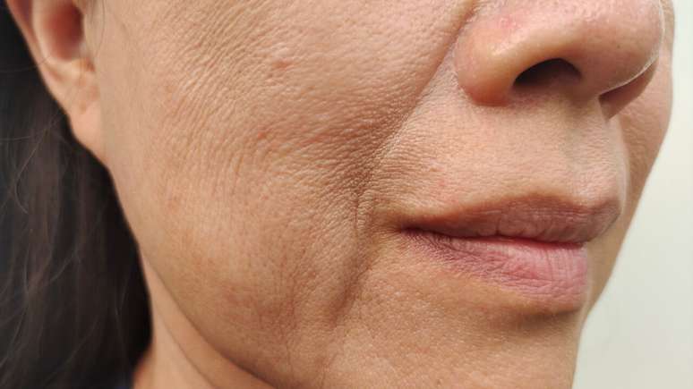 The nutritionist points to food that can make the skin more flabby