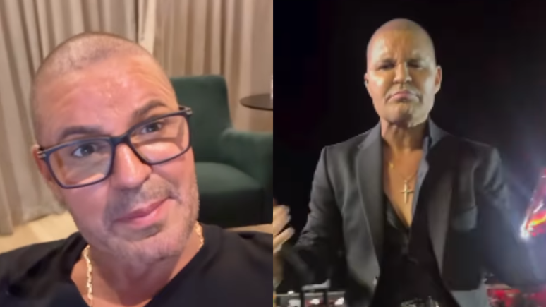 Eduardo Costa revela motivo inusitado da queda de seu cabelo: 'Usei muita'