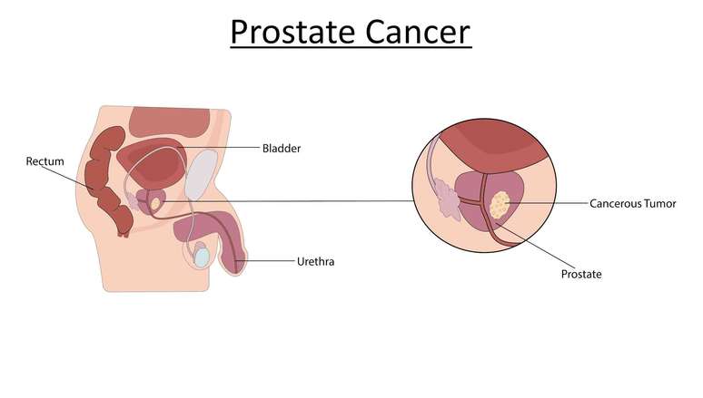A próstata fica abaixo da bexiga. izunna/Shutterstock