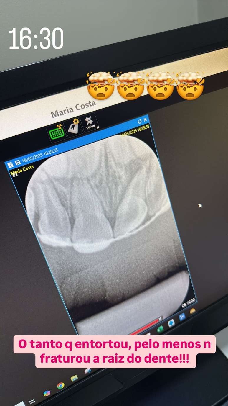 Virginia shares the X -rays of the Dental Arch of Maria Flor Virginia shares the X -rays of the Dental Arch of Maria Flor