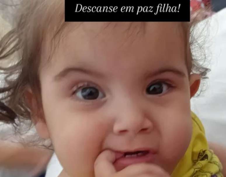 Hospital declara morte encefálica de Kiraz, uma das siamesas separadas em Goiás
