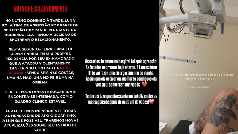 Stories da influenciadora Luna