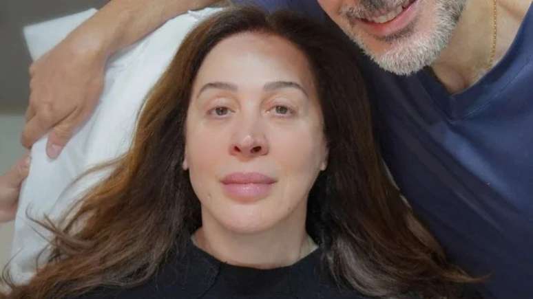 What are the collagen threads that Claudia Raia has put to improve her falling face? What are the collagen threads that Claudia Raia has put to improve her falling face?