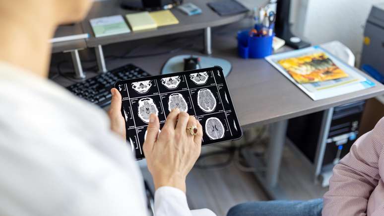 The researchers find a new method capable of reducing time to diagnose brain tumors