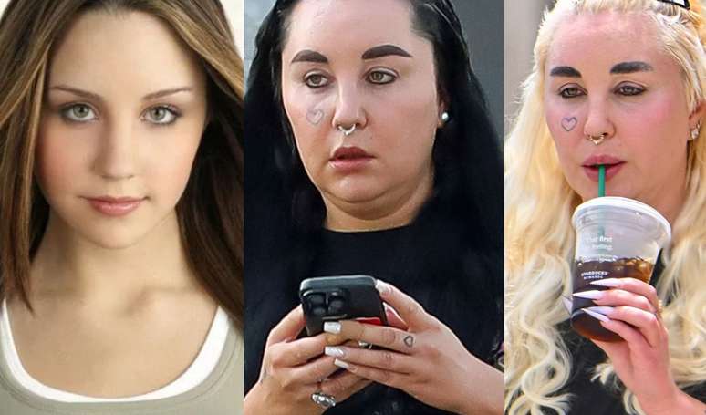 Amanda Bynes before and after: 25 photos of the controversial transformation of the former teenage star of 2000 who worries fans Amanda Bynes before and after: 25 photos of the controversial transformation of the former teenage star of 2000 who worries fans
